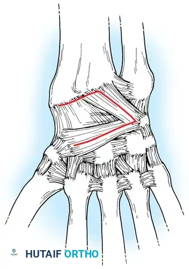 Hutaifortho's Orthopaedic Diagram