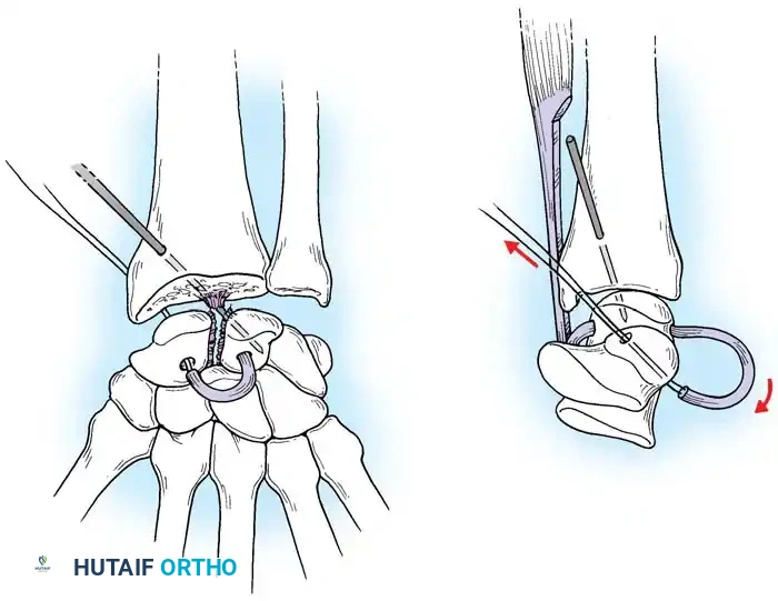 Hutaifortho's Orthopaedic Diagram