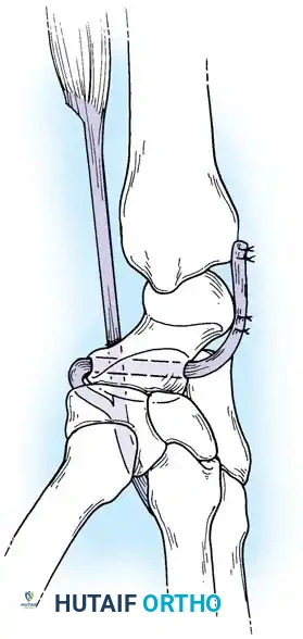 Hutaifortho's Orthopaedic Diagram