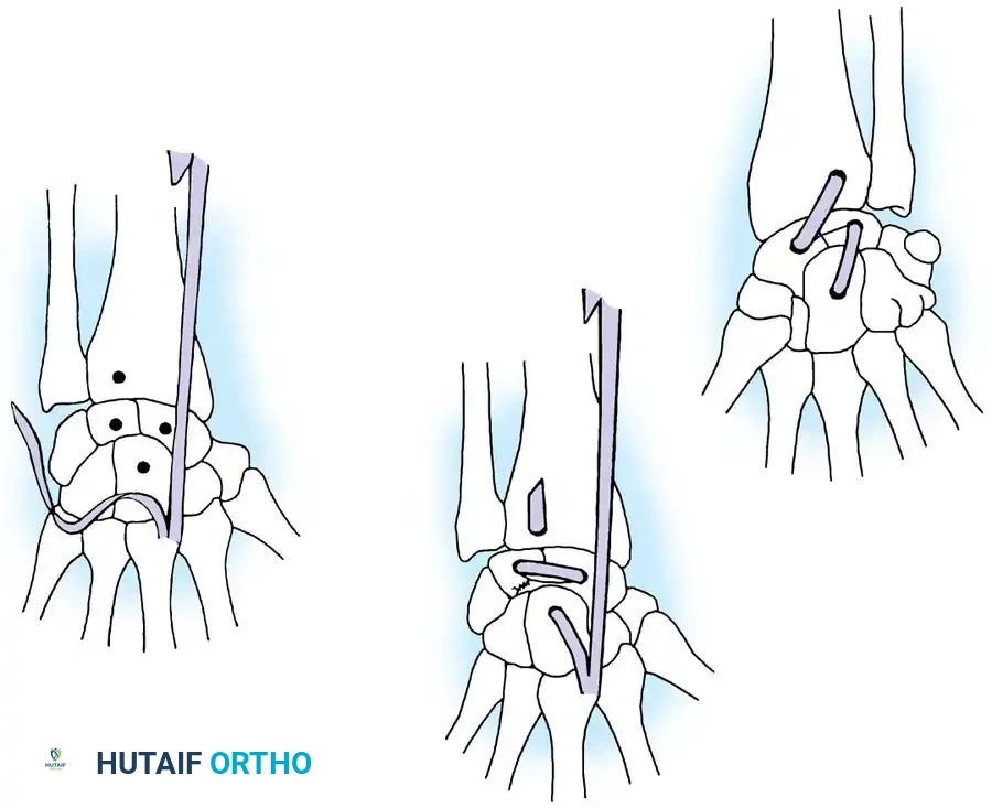 Hutaifortho's Orthopaedic Diagram