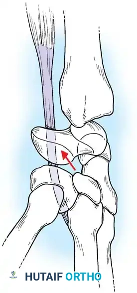 Hutaifortho's Orthopaedic Diagram