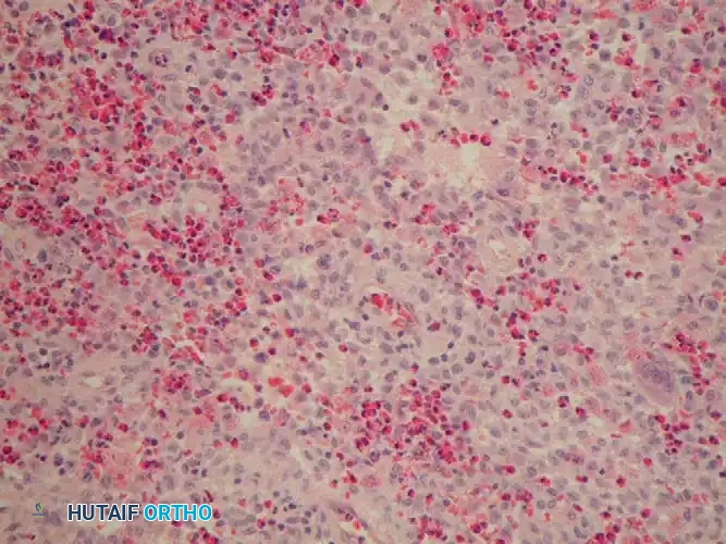 Hutaifortho's Orthopaedic Diagram