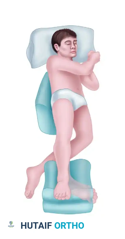 FIGURE 89-59 Anterolateral (A) and anteromedial (B) portals for arthroscopic excision of osteochondritis dissecans of ankle.