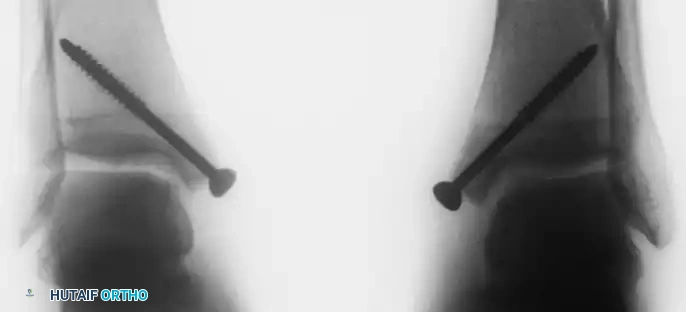 Hutaifortho's Orthopaedic Diagram