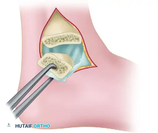 Hutaifortho's Orthopaedic Diagram