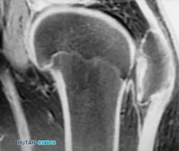 Hutaifortho's Orthopaedic Diagram