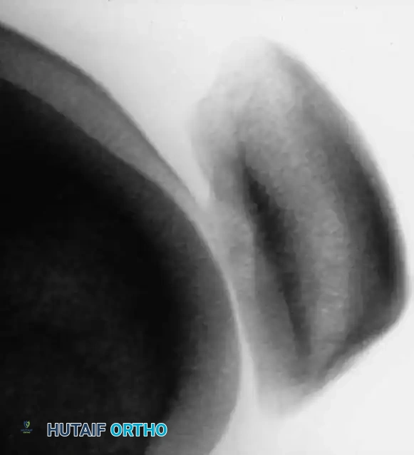 Hutaifortho's Orthopaedic Diagram