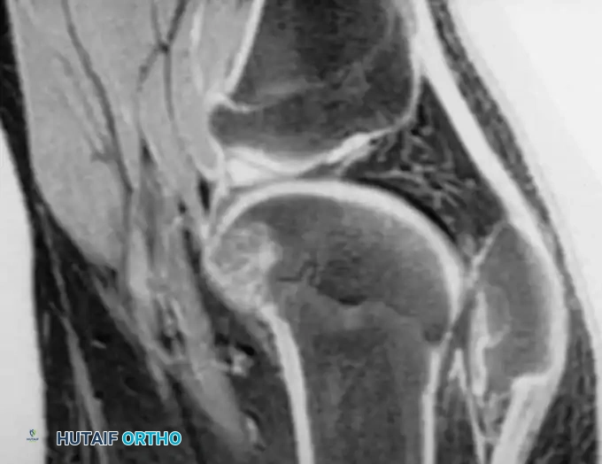 Hutaifortho's Orthopaedic Diagram