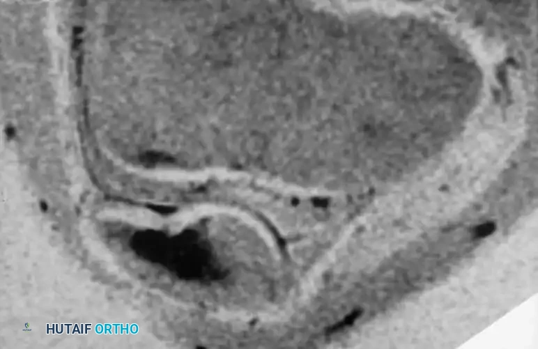 Hutaifortho's Orthopaedic Diagram