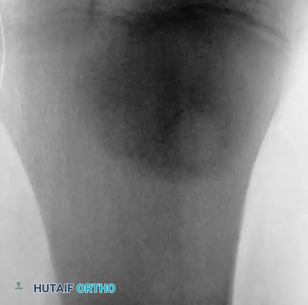 Hutaifortho's Orthopaedic Diagram