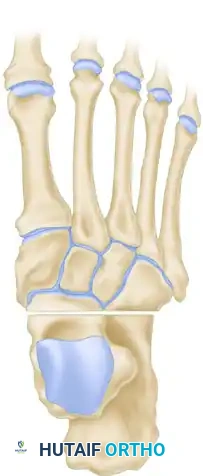 OSTEOTOMY OF THE CALCANEUS Surgical Diagram