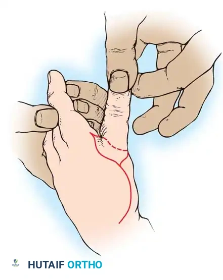 Hutaifortho's Orthopaedic Diagram
