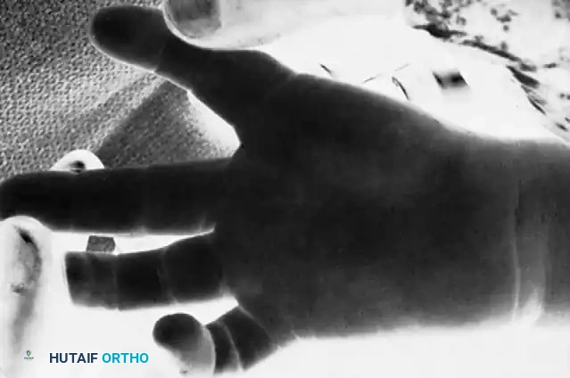 Hutaifortho's Orthopaedic Diagram