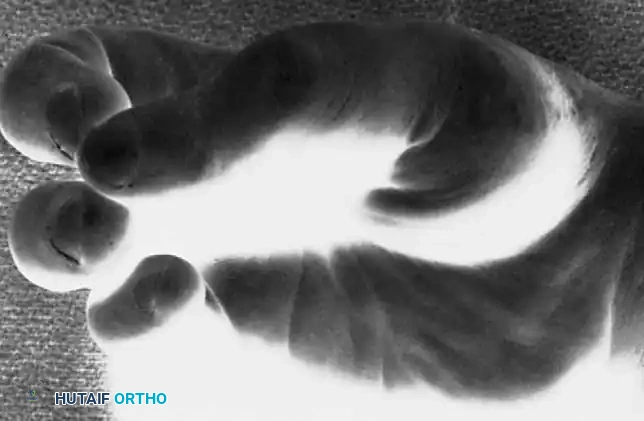 Hutaifortho's Orthopaedic Diagram