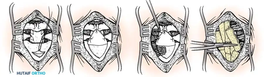 Hutaifortho's Orthopaedic Diagram