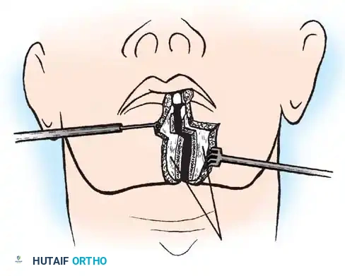 Hutaifortho's Orthopaedic Diagram