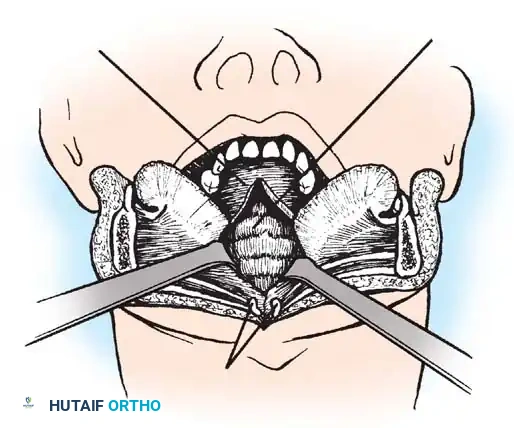 Hutaifortho's Orthopaedic Diagram