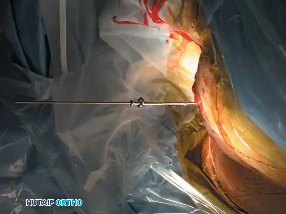 Hutaifortho's Orthopaedic Diagram