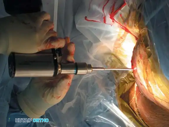 Hutaifortho's Orthopaedic Diagram