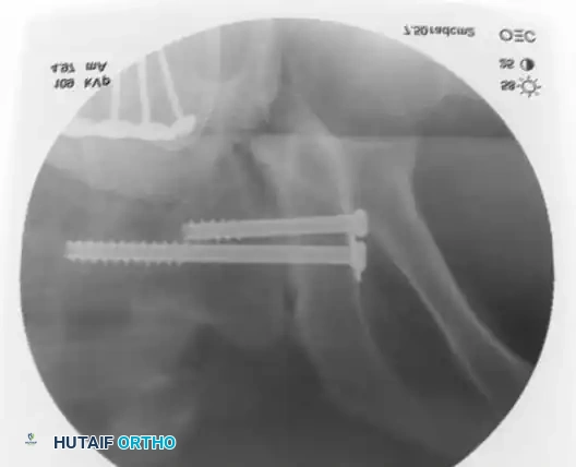 Hutaifortho's Orthopaedic Diagram