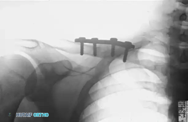PELVIS AND ACETABULUM Surgical Diagram