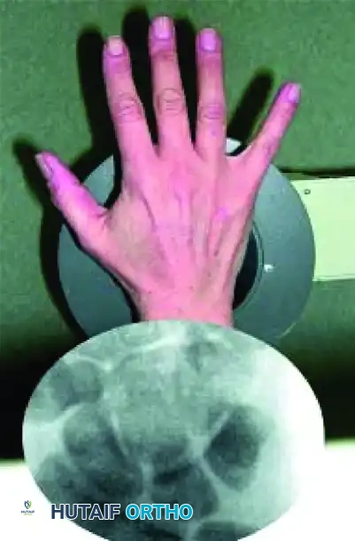 Fluoroscopic Targeting B