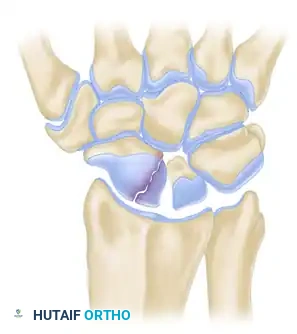 Scaphoid Anatomy Diagram