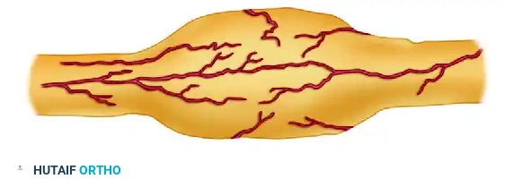 Mastering Interfascicular Nerve Grafting and Perineurial Neurorrhaphy