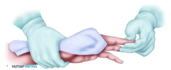 FIGURE 64-2 Assistant holds patient’s hand firm and motion­ less and exposes operative field for midlateral digital incision.