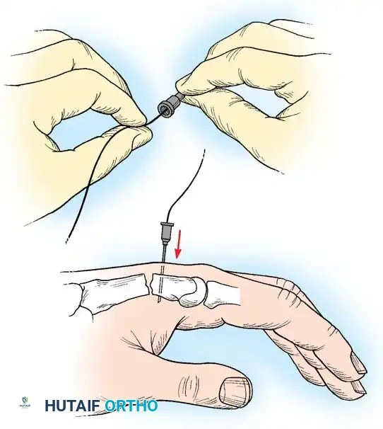 Hutaifortho's Orthopaedic Diagram