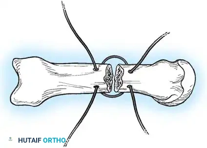 Hutaifortho's Orthopaedic Diagram