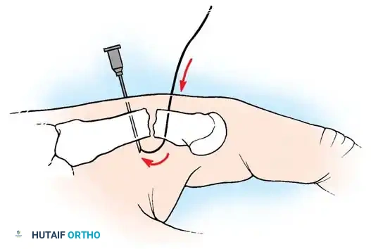 Hutaifortho's Orthopaedic Diagram