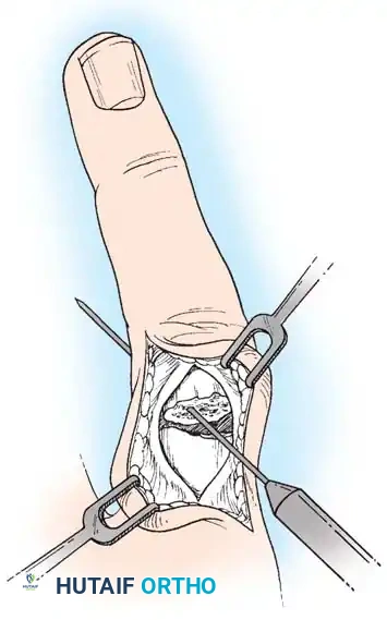 Hutaifortho's Orthopaedic Diagram
