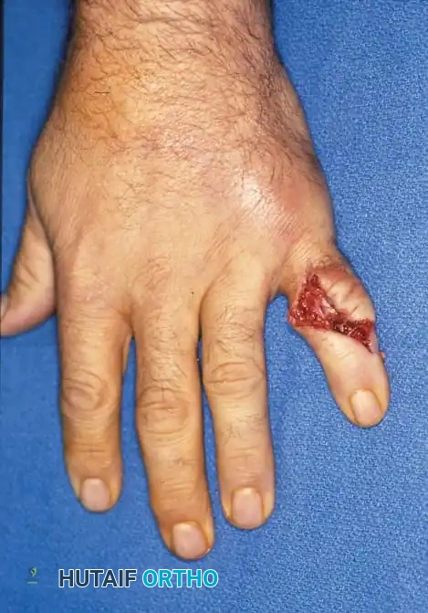 Hutaifortho's Orthopaedic Diagram