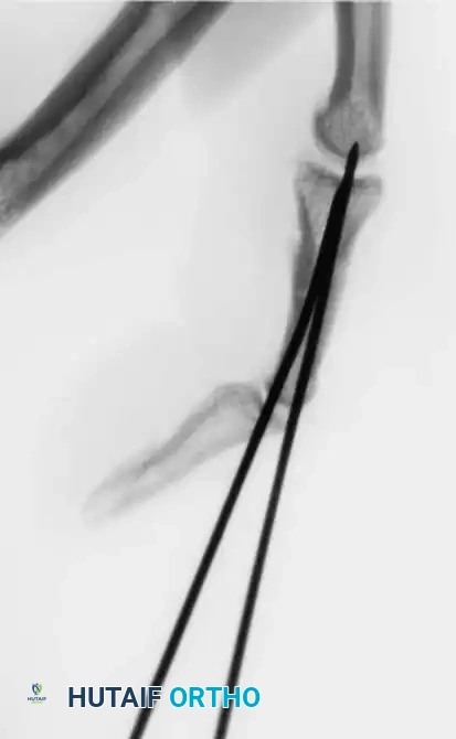 Hutaifortho's Orthopaedic Diagram