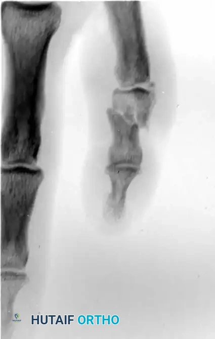 Hutaifortho's Orthopaedic Diagram