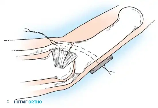 Hutaifortho's Orthopaedic Diagram