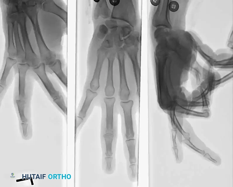 Hutaifortho's Orthopaedic Diagram