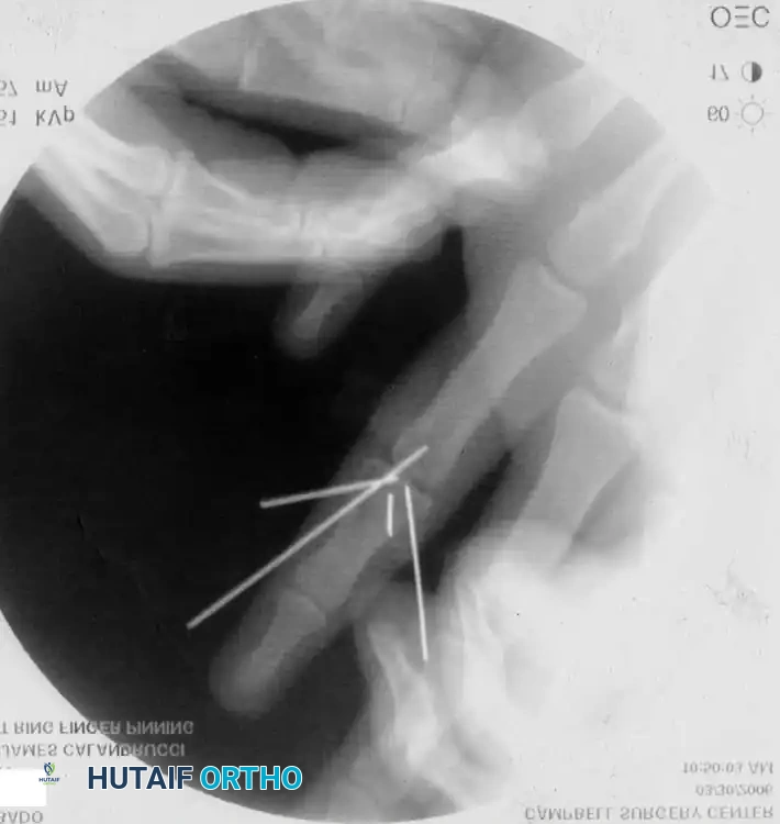 Hutaifortho's Orthopaedic Diagram