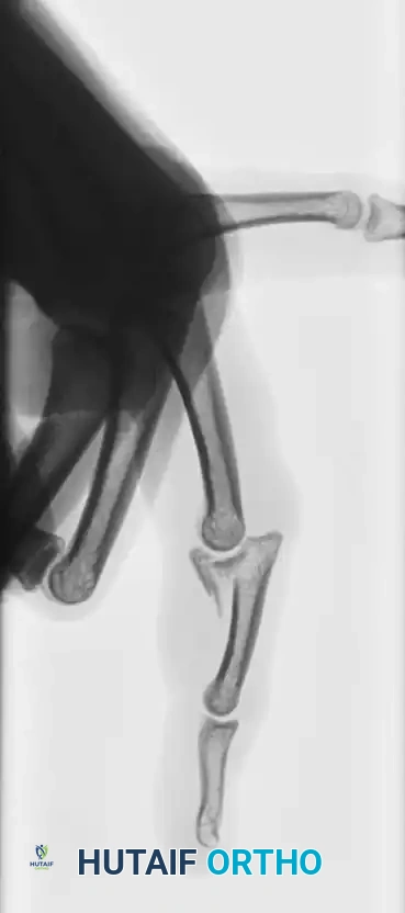 Hutaifortho's Orthopaedic Diagram