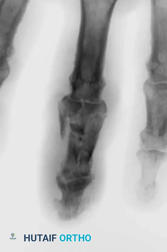 Hutaifortho's Orthopaedic Diagram