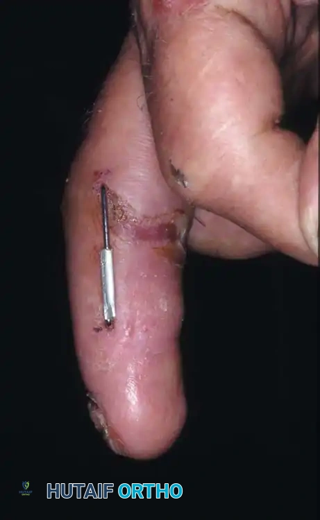 Hutaifortho's Orthopaedic Diagram