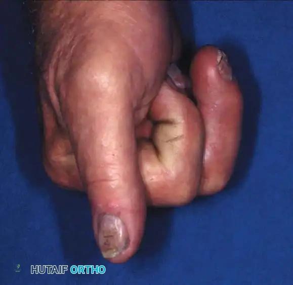 Hutaifortho's Orthopaedic Diagram