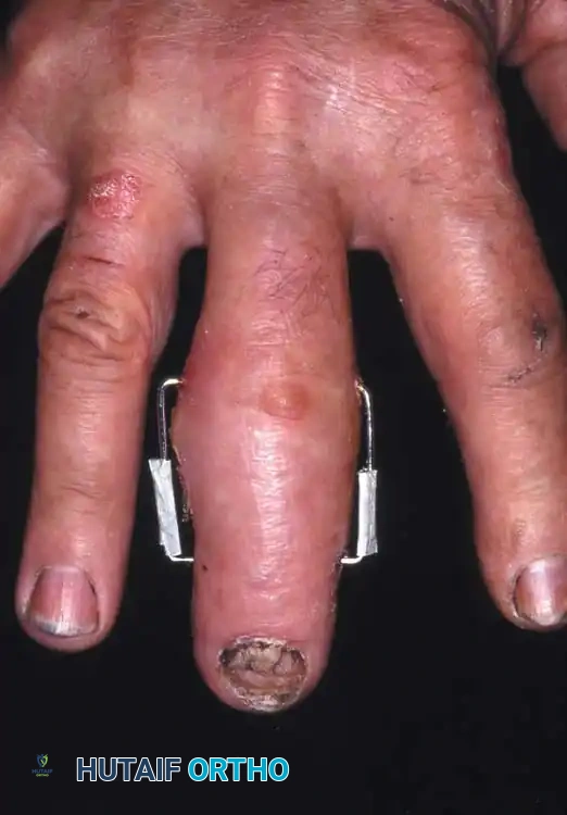 Hutaifortho's Orthopaedic Diagram