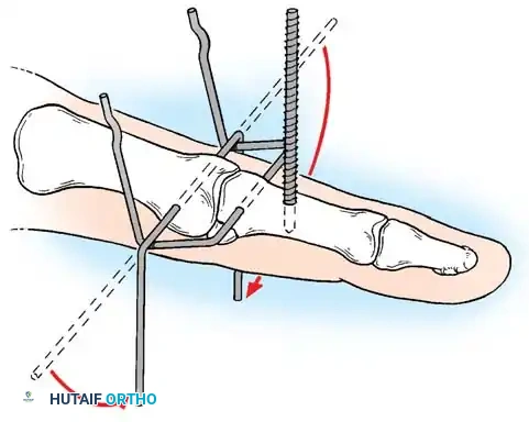 Hutaifortho's Orthopaedic Diagram
