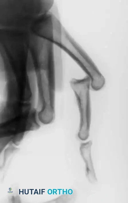 Hutaifortho's Orthopaedic Diagram