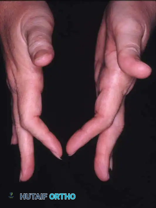 Hutaifortho's Orthopaedic Diagram