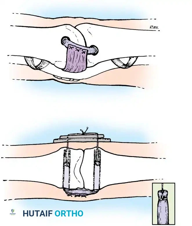 Hutaifortho's Orthopaedic Diagram