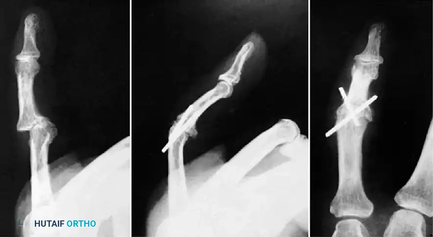 Hutaifortho's Orthopaedic Diagram