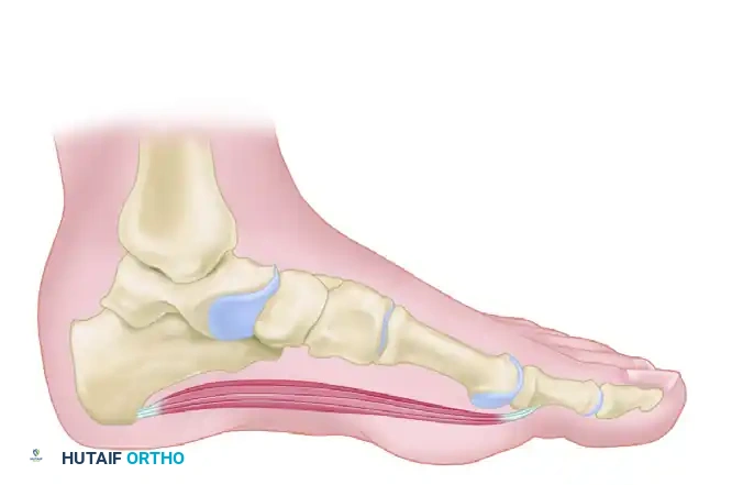 Abductor hallucis muscle is reflected proximally